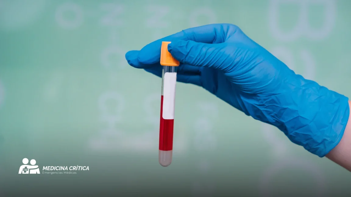 Hemograma: qué es, para qué sirve y cómo interpretar tus resultados 2 Hemograma que es