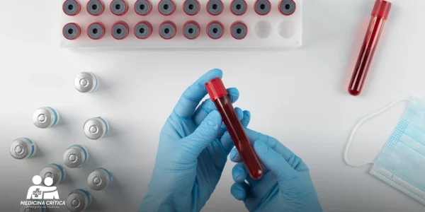 Antígeno carcinoembrionario